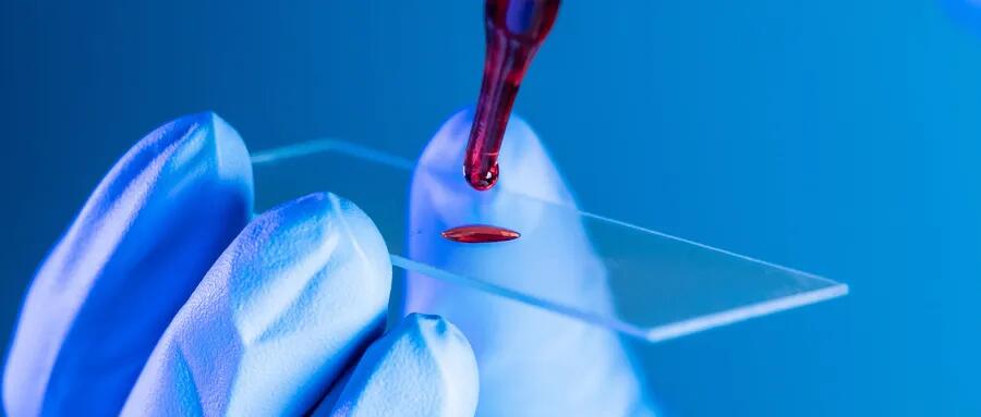 【原創(chuàng)研究】血液制品行業(yè)投研報(bào)告之二：國(guó)內(nèi)企業(yè)分離提純工藝仍有較大提升空間